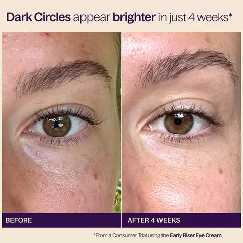 Before & After with Reduced Dark Circles from the Early Riser Eye Cream