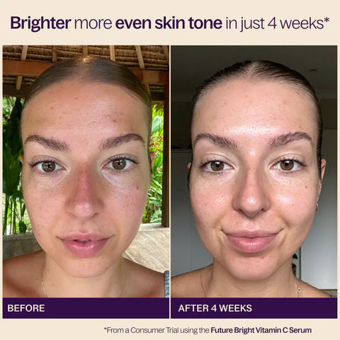 Before & After with Brighter Glowing Skin, The Future Bright Vitamin C Serum